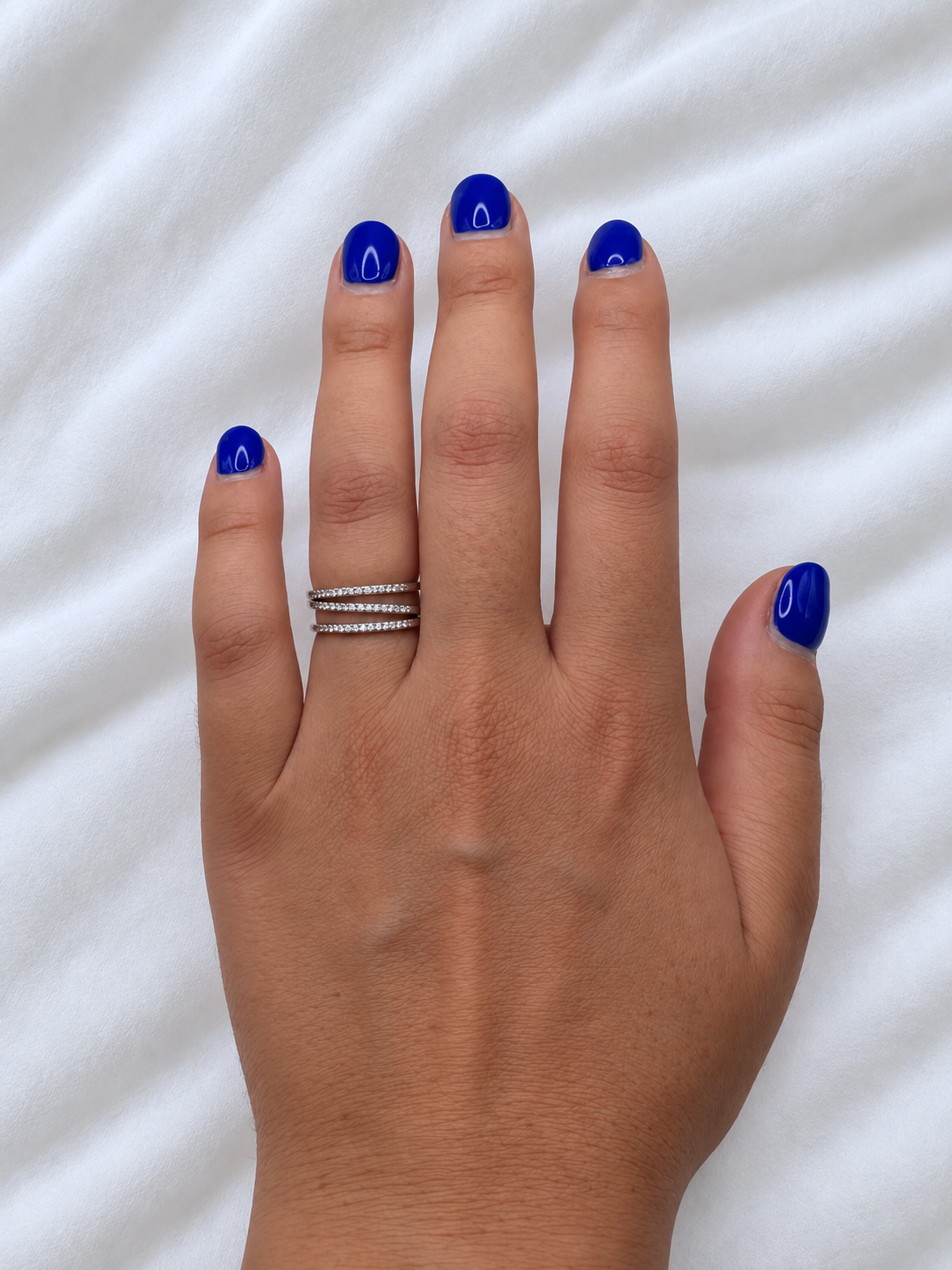 Anello Teti